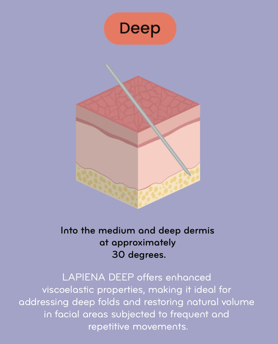 Lapiena Deep injection layer